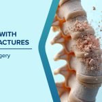 Spine Trauma & Fractures – Why Immediate Treatment Is Crucial